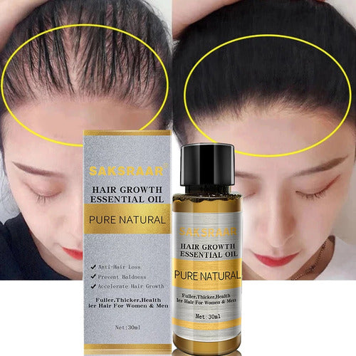 Hair Loss Growth Oil